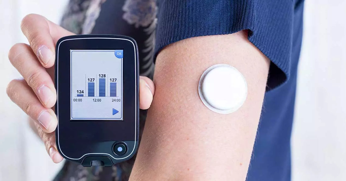 Guía Completa de Monitores de Glucosa: Opciones para el Control de la Diabetes